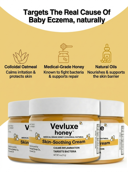 Vevlux's™ Honey Eczema Cream